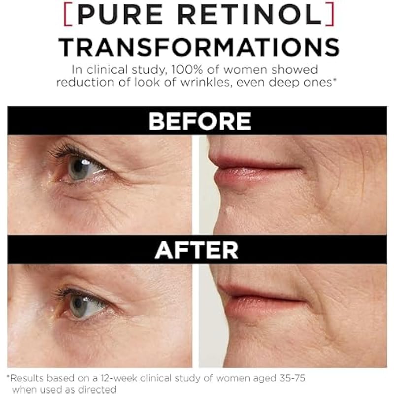 L’Oréal Paris Night Retinol Serum for Face, Revitalift Triple Power LZR, With 0.3% Pure Retinol, Moisturizes Skin and Eliminates Look of Deep Wrinkles, Skincare, 30 ml